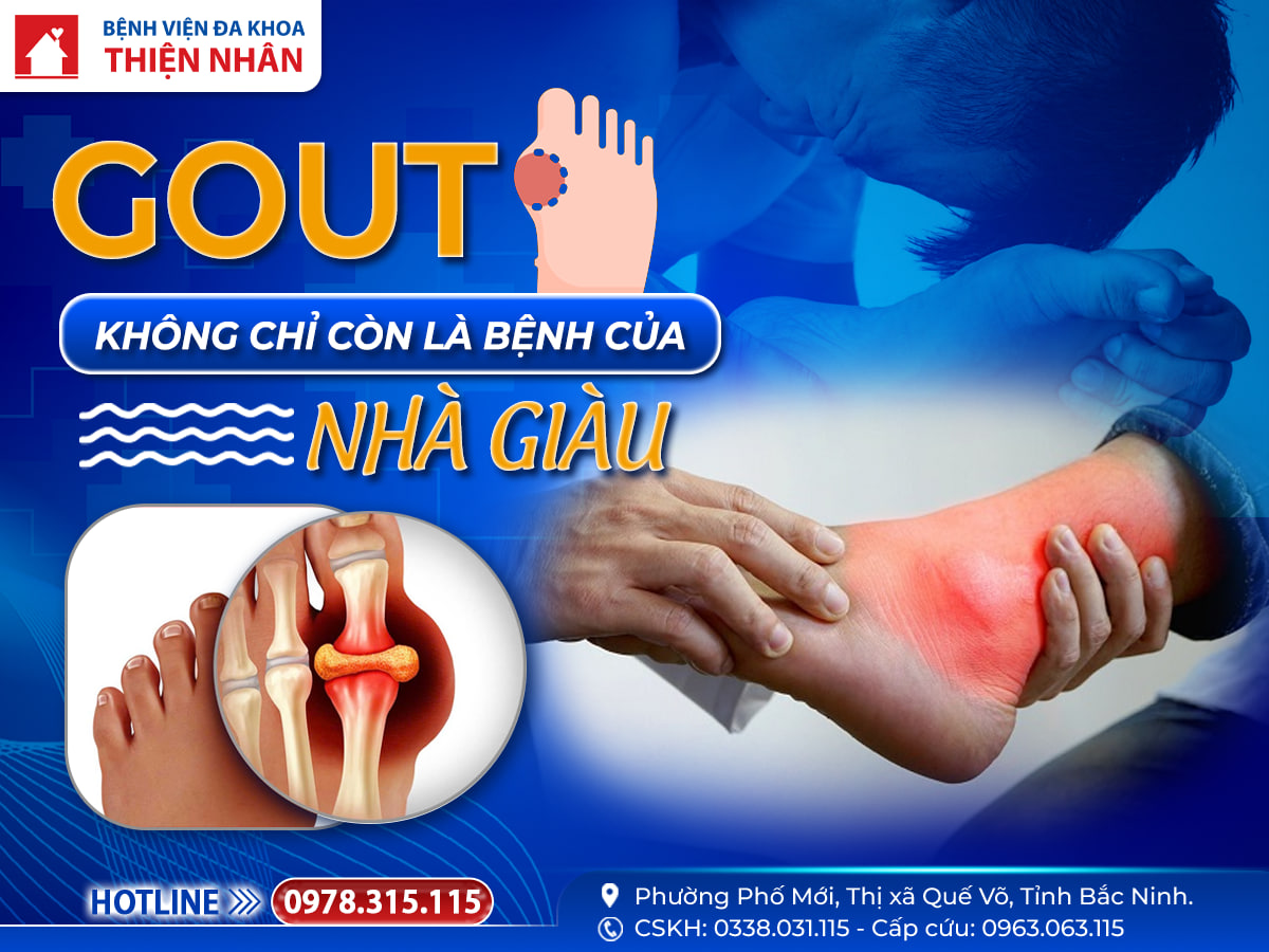 https://benhvienthiennhan.com/gout-can-benh-ngay-cang-tre-hoa-nguyen-nhan-va-cach-dieu-tri