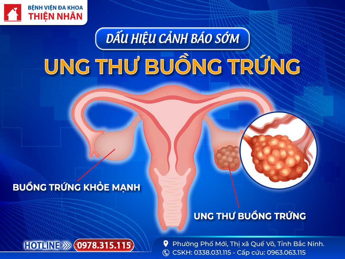 https://benhvienthiennhan.com/dau-hieu-canh-bao-som-ung-thu-buong-trung