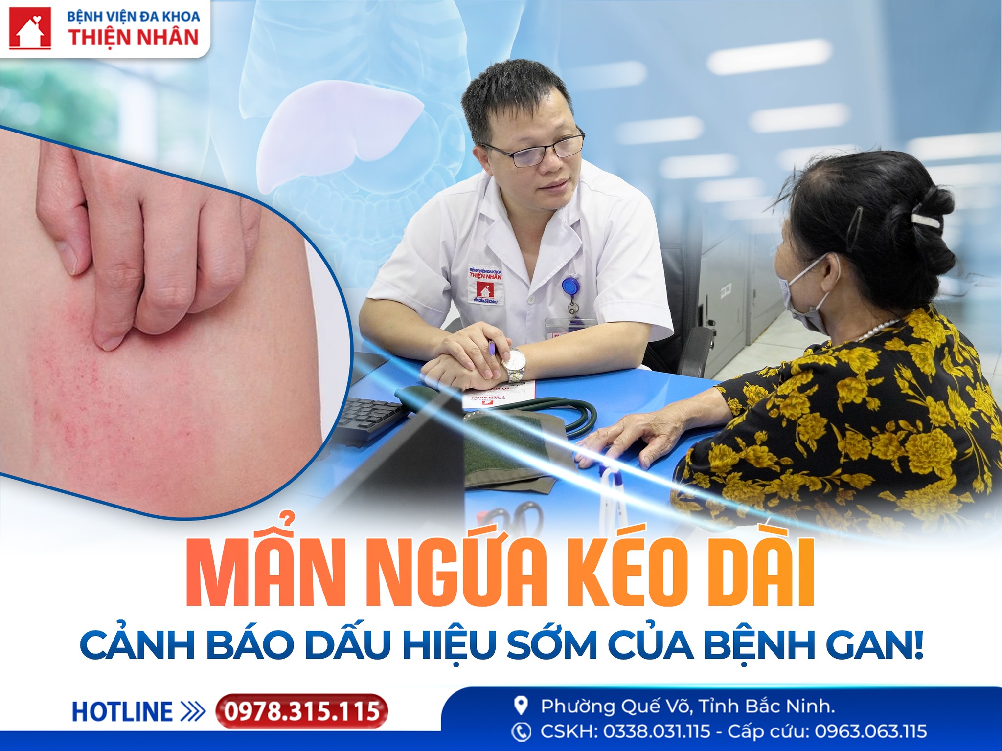 https://benhvienthiennhan.com/man-ngua-keo-dai-–-canh-bao-dau-hieu-som-cua-benh-gan