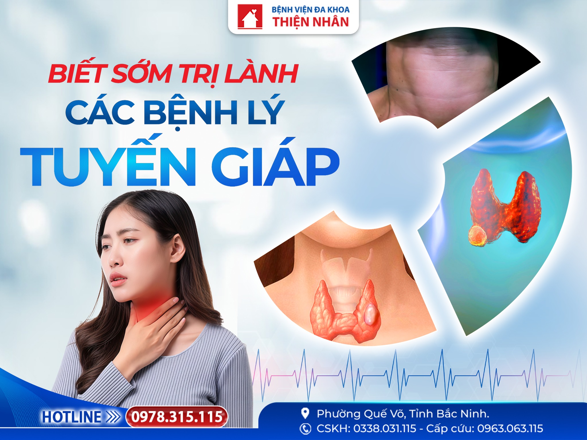 https://benhvienthiennhan.com/rui-ro-tham-lang-tu-cac-benh-ly-tuyen-giap-–-dung-chu-quan- 