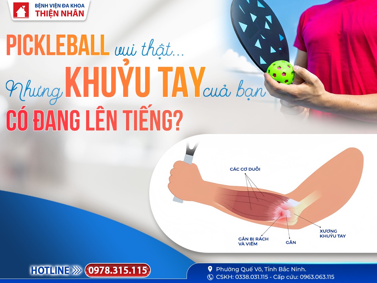 https://benhvienthiennhan.com/khuyu-tay-pickleball-–-dau-hieu-viem-gan-nhieu-nguoi-choi-de-bo-qua