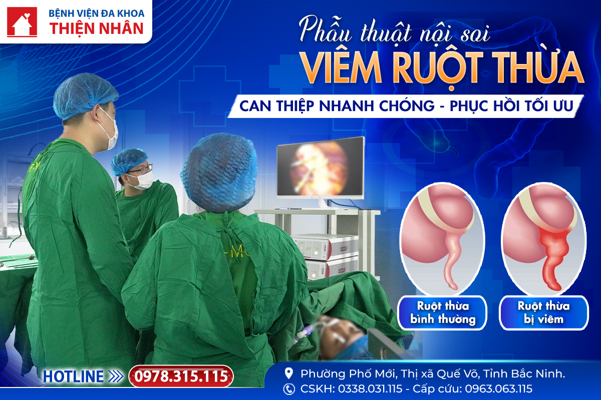 PHẪU THUẬT NỘI SOI VIÊM RUỘT THỪA – CAN THIỆP NHANH CHÓNG, PHỤC HỒI TỐI ƯU TẠI BỆNH VIỆN ĐA KHOA THIỆN NHÂN