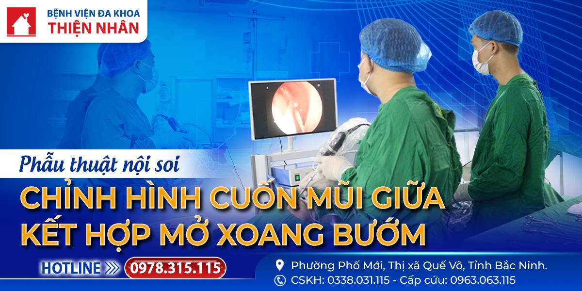 PHẪU THUẬT NỘI SOI CHỈNH HÌNH CUỐN MŨI GIỮA KẾT HỢP MỞ XOANG BƯỚM – GIẢI PHÁP HIỆU QUẢ CHO BỆNH NHÂN VIÊM MŨI XOANG MẠN TÍ