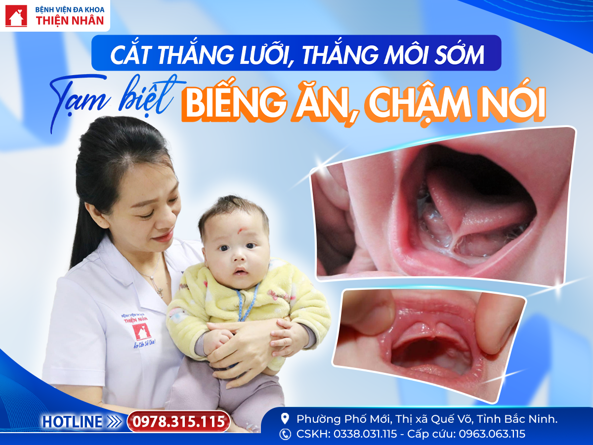 CẮT THẮNG LƯỠI, THẮNG MÔI SỚM – GIẢI PHÁP GIÚP TRẺ ĂN TỐT, PHÁT TRIỂN TOÀN DIỆN NGAY TỪ NHỮNG NĂM THÁNG ĐẦU ĐỜI